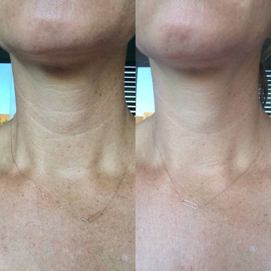 Anti-Aging Halsmaske