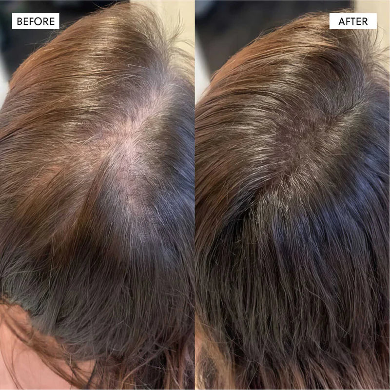 Hair Growth Accelerator