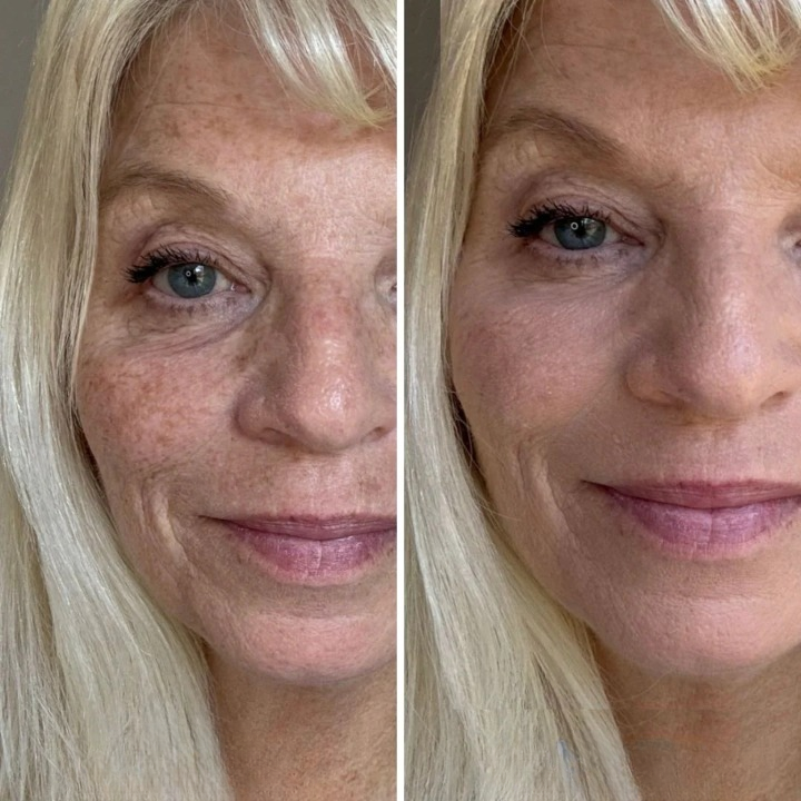 Pro-Age Fargeforandrende Foundation